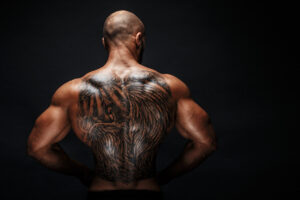 remoção tatuagem em pele negra
