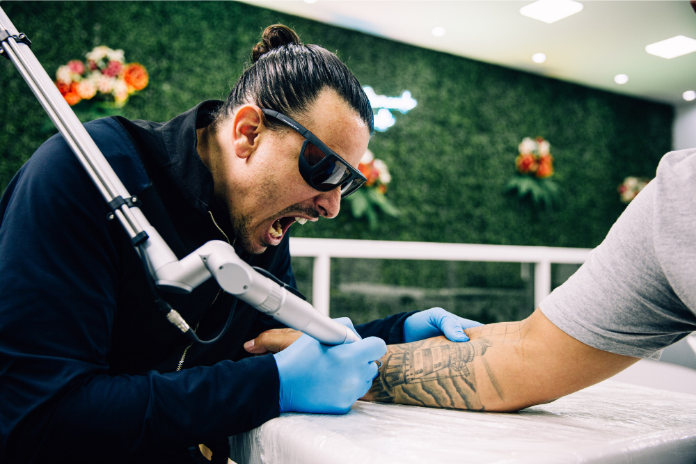 Quanto cobrar por tratamentos de remoção de tatuagem a laser